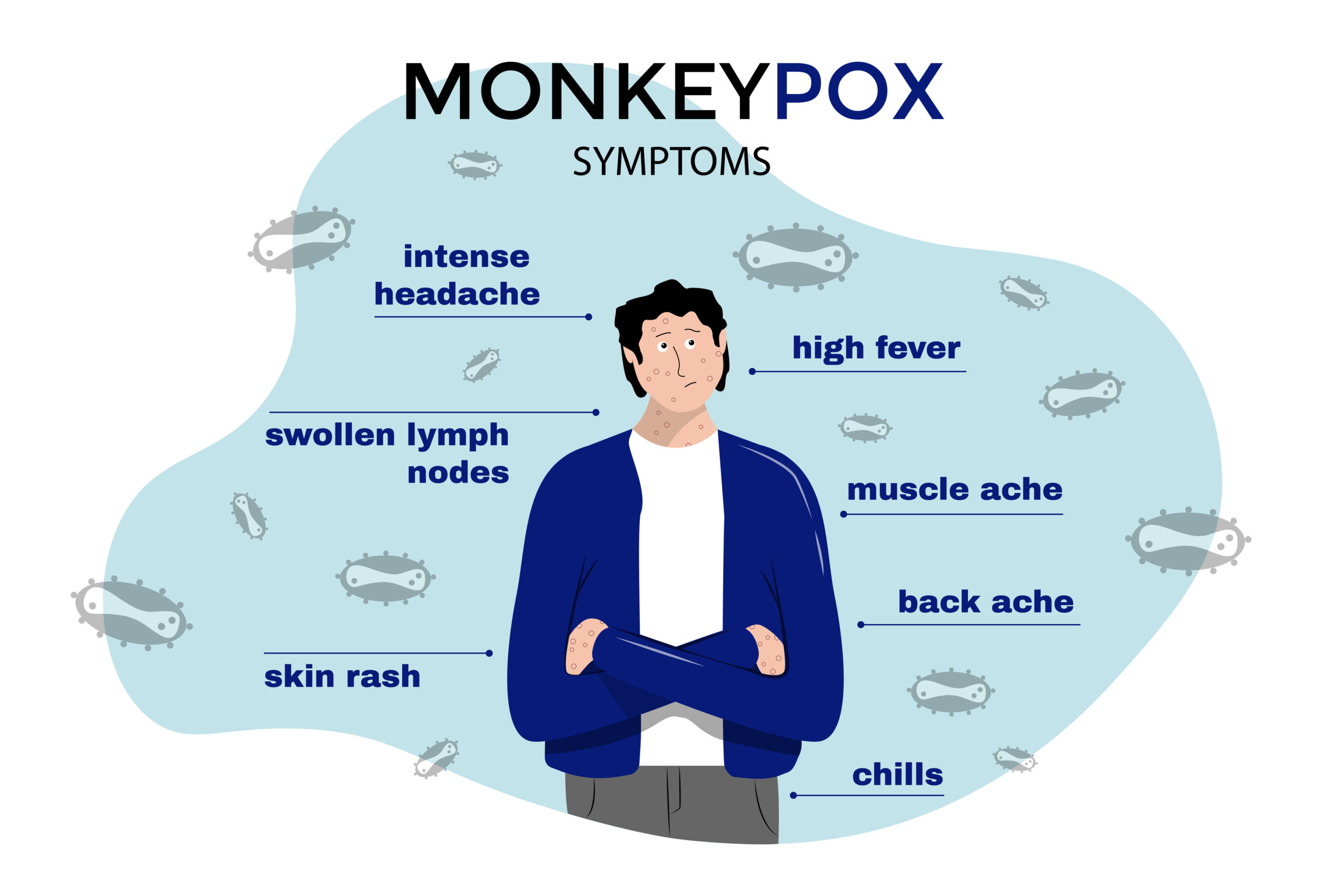 Thumbnail for MonkeyPox Prevelance Dashboard